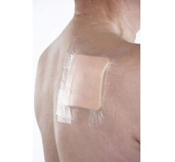 OPSITE Flexifix Gentle 10cm X 5m (P=12) Sanft Haftende Transparente Fixierfolie -Coloplast Verkaufsgeschäft SMI Opsite Flexi Gent 02 2