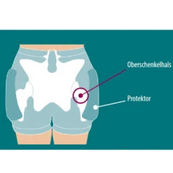 Suprima Protektor-Slip Set 1 ( 2 X 1490 + 1 X 2007 ), Hüftschutzhosen Im Set, Für Damen & Herren, Mit Zwei Hosen Und Einem Protektorpaar 7 Suprima Protektor-Slip Set 1 ( 2 X 1490 + 1 X 2007 ), Hüftschutzhosen Im Set, Für Damen & Herren, Mit Zwei Hosen Und Einem Protektorpaar -Coloplast Verkaufsgeschäft SUP Oberschenkel Protekt