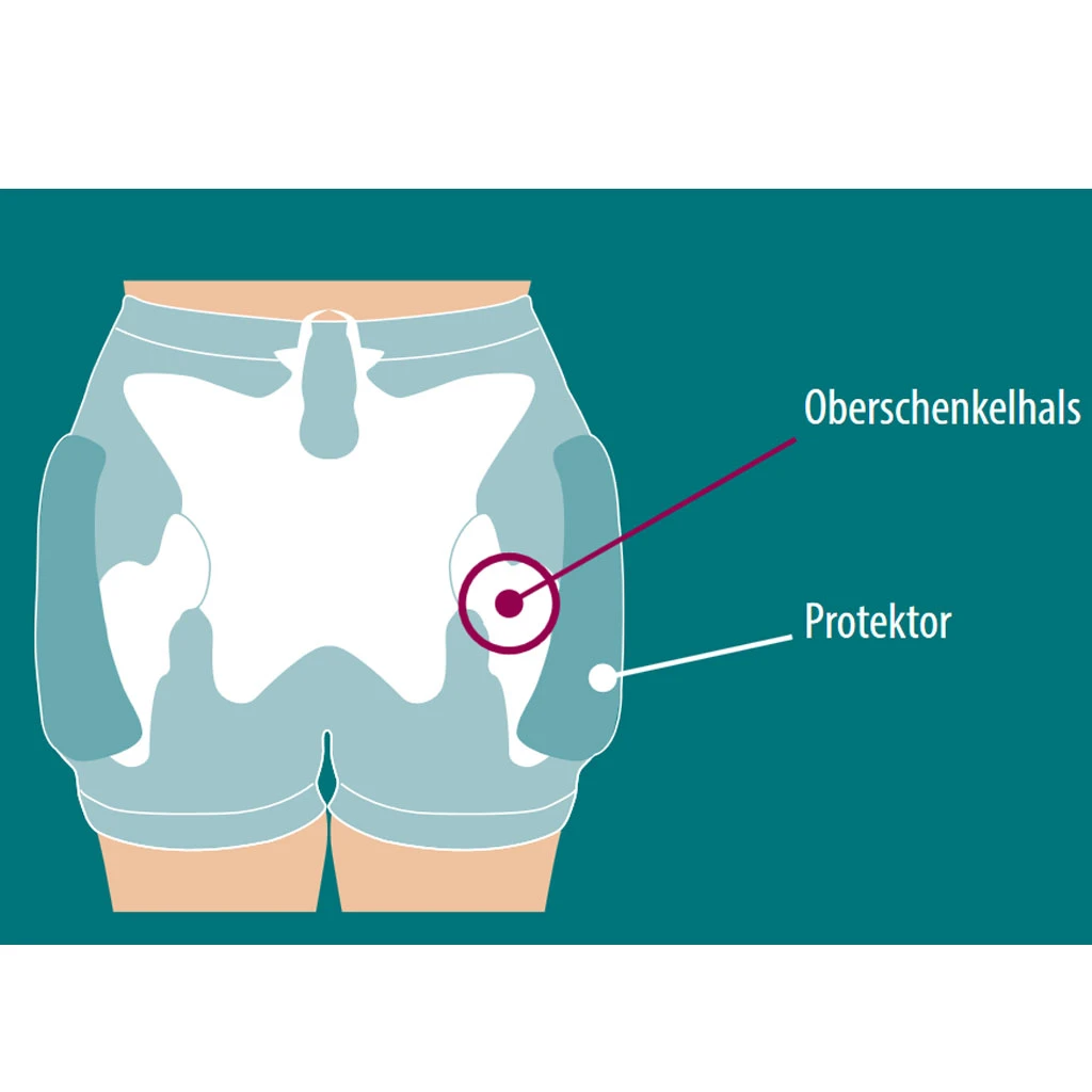 Suprima Protektor-Slip Set 1 ( 2 X 1490 + 1 X 2007 ), Hüftschutzhosen Im Set, Für Damen & Herren, Mit Zwei Hosen Und Einem Protektorpaar 5 Suprima Protektor-Slip Set 1 ( 2 X 1490 + 1 X 2007 ), Hüftschutzhosen Im Set, Für Damen & Herren, Mit Zwei Hosen Und Einem Protektorpaar – Bild 3