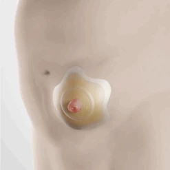 Coloplast SenSura Mio Click Konkav Basisplatte, RR 50mm, Stoma 10-45mm, P=5 Stück, PZN 12547726 -Coloplast Verkaufsgeschäft Screenshot 2021 05 04 SenSura Mio Click Konkav Basisplatte 2 1 5