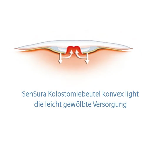 Coloplast SenSura Kolostomiebeutel Konvex Light, Transparent, P=10 Stück 4 Coloplast SenSura Kolostomiebeutel Konvex Light, Transparent, P=10 Stück – Bild 2