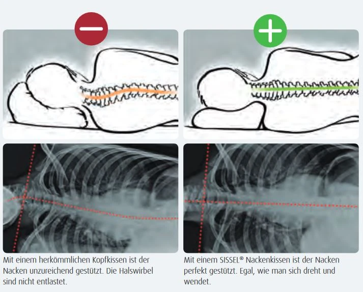 SISSEL Classic PLUS Nackenkissen, Höhe Des Kissens Ist Variabel Durch Die Herausnehmbare Vario-Einlage 7 SISSEL Classic PLUS Nackenkissen, Höhe Des Kissens Ist Variabel Durch Die Herausnehmbare Vario-Einlage – Bild 5
